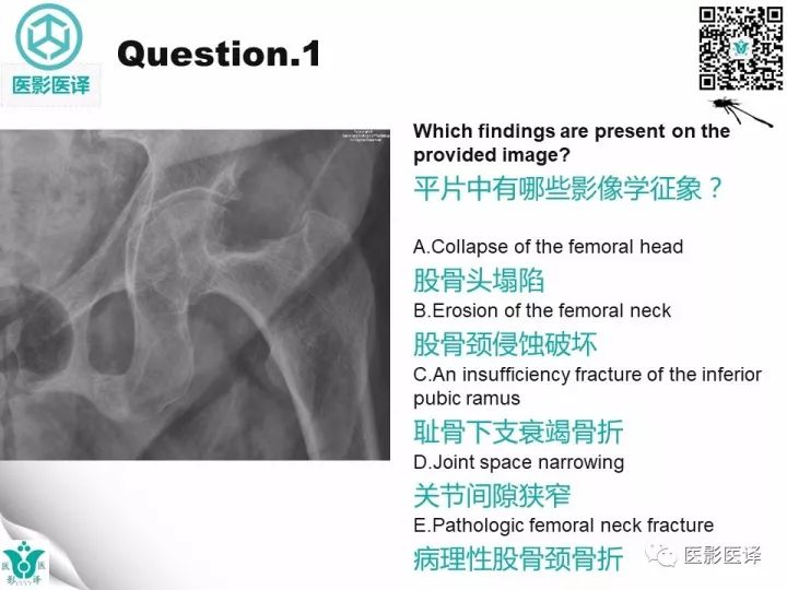 【病例】透析相关性淀粉样变1例X线CT及MR