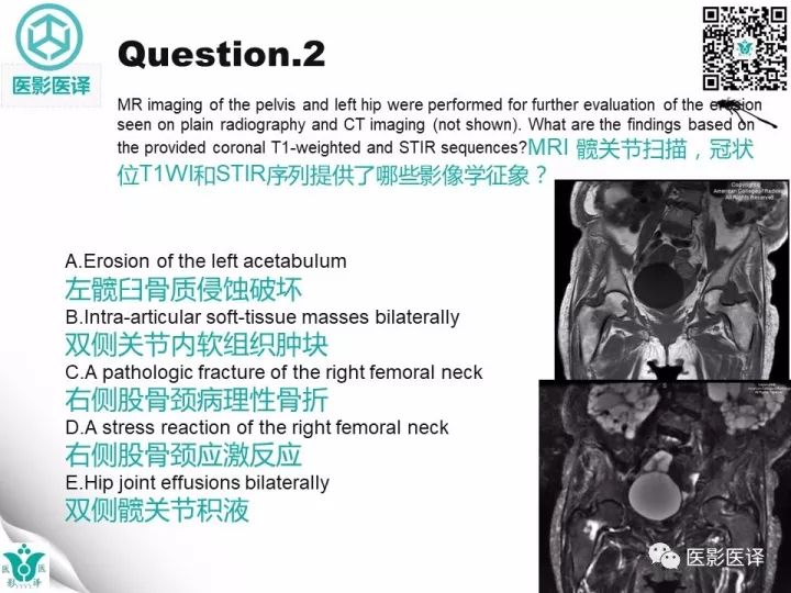 【病例】透析相关性淀粉样变1例X线CT及MR