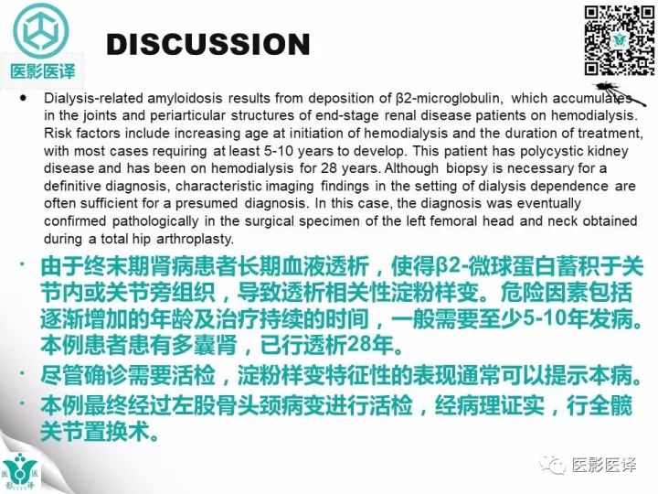 【病例】透析相关性淀粉样变1例X线CT及MR
