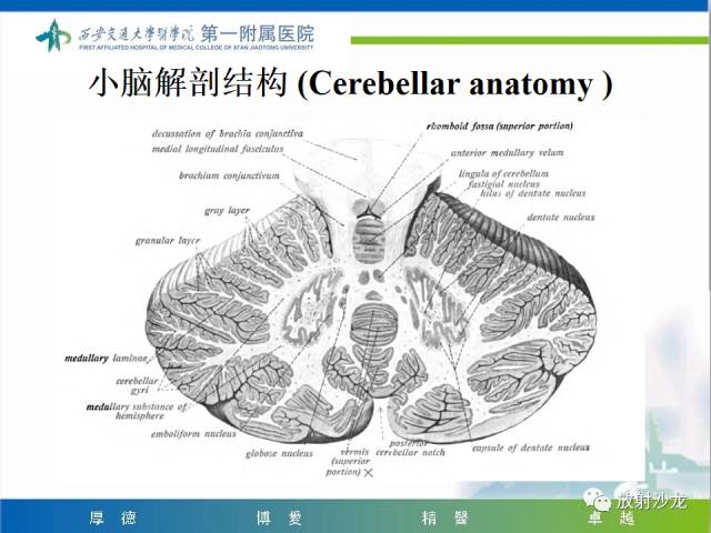 【病例】山豆根中毒1例CT及MR影像表现