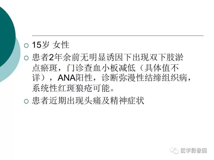 【病例】狼疮性脑病1例MR影像表现