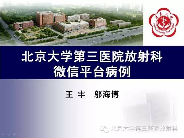 【病例】淋巴细胞性垂体炎1例MR影像表现