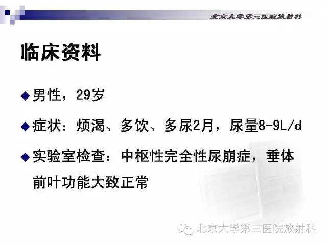 【病例】淋巴细胞性垂体炎1例MR影像表现