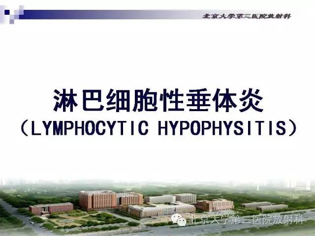 【病例】淋巴细胞性垂体炎1例MR影像表现