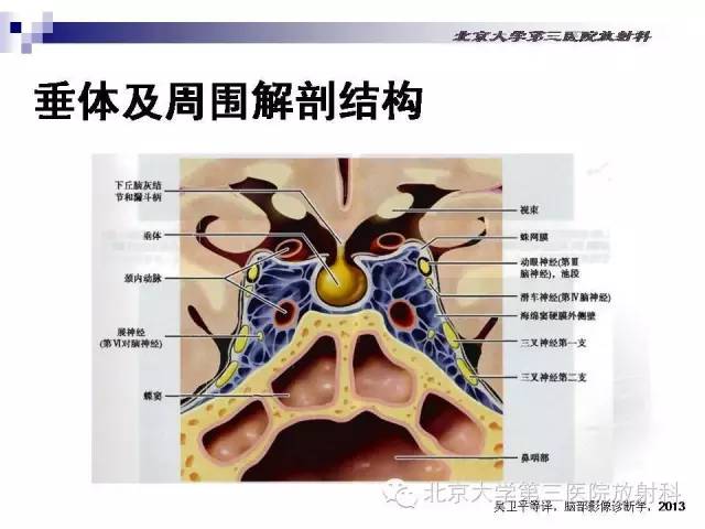 【病例】淋巴细胞性垂体炎1例MR影像表现