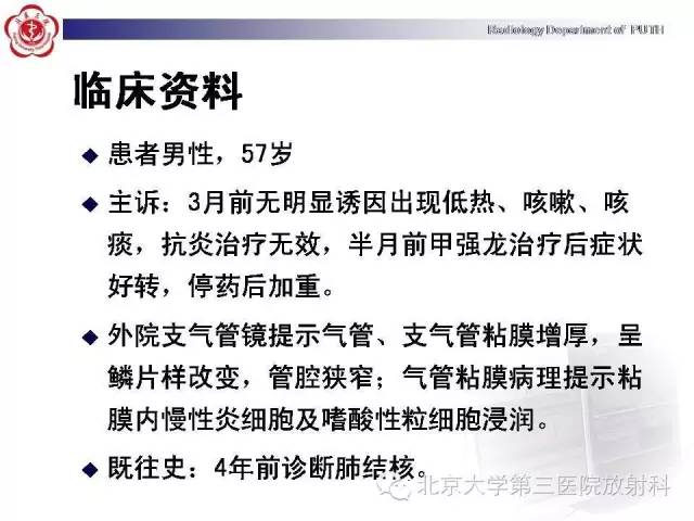 【病例】复发性多软骨炎1例CT影像表现
