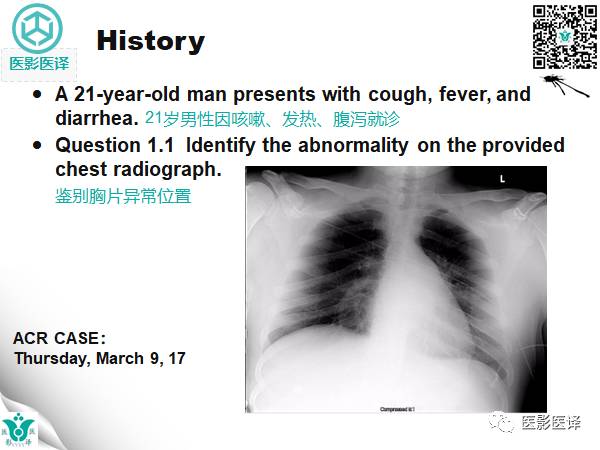 【病例】降主动脉胸段真菌性动脉瘤包裹性破裂1例
