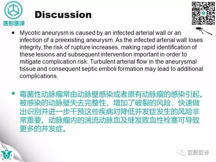 【病例】降主动脉胸段真菌性动脉瘤包裹性破裂1例