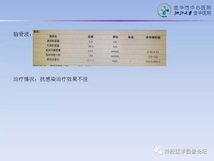 【病例】表现为结节的小脑胶母1例MR