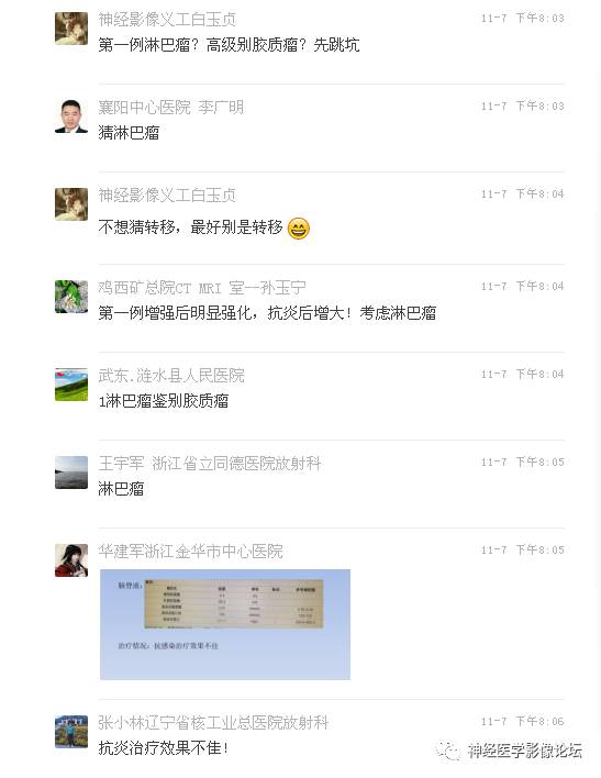 【病例】表现为结节的小脑胶母1例MR
