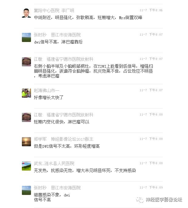 【病例】表现为结节的小脑胶母1例MR