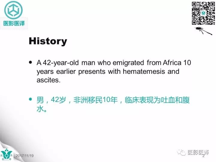 【病例】肝血吸虫病1例CT影像表现