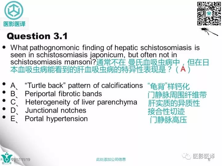【病例】肝血吸虫病1例CT影像表现
