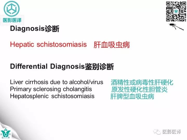【病例】肝血吸虫病1例CT影像表现