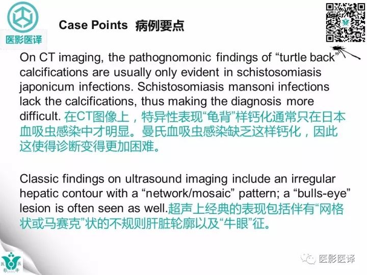 【病例】肝血吸虫病1例CT影像表现