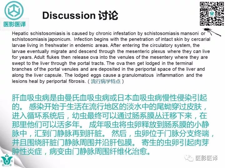 【病例】肝血吸虫病1例CT影像表现