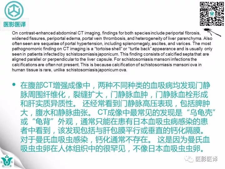 【病例】肝血吸虫病1例CT影像表现