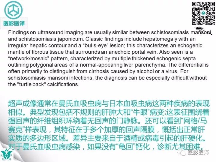 【病例】肝血吸虫病1例CT影像表现
