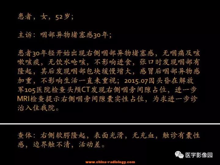 【病例】颈部神经鞘瘤1例CT影像表现