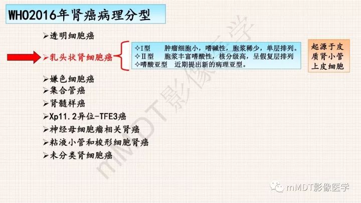 【PPT】乳头状肾细胞癌影像诊断