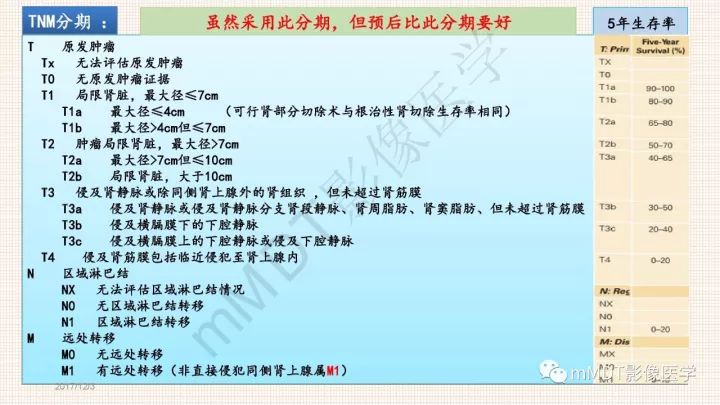 【PPT】乳头状肾细胞癌影像诊断