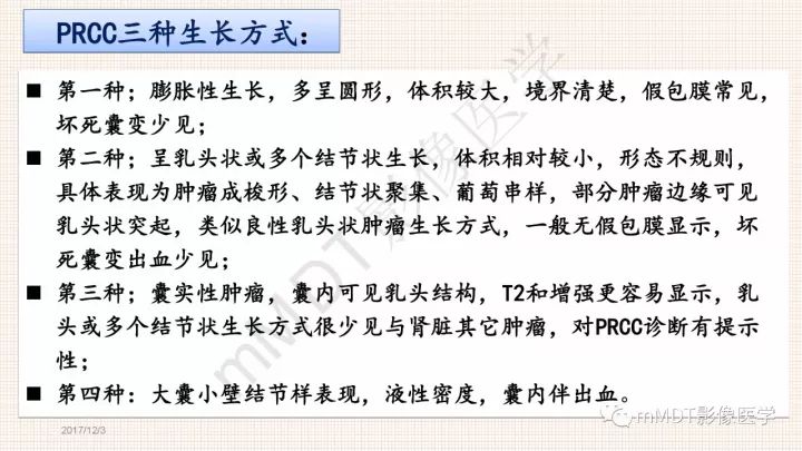 【PPT】乳头状肾细胞癌影像诊断