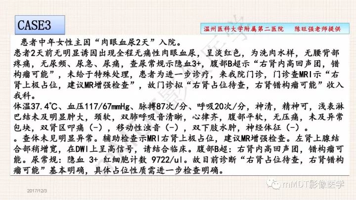 【PPT】乳头状肾细胞癌影像诊断