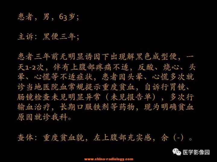 【病例】腹腔恶性间质瘤1例CT影像表现