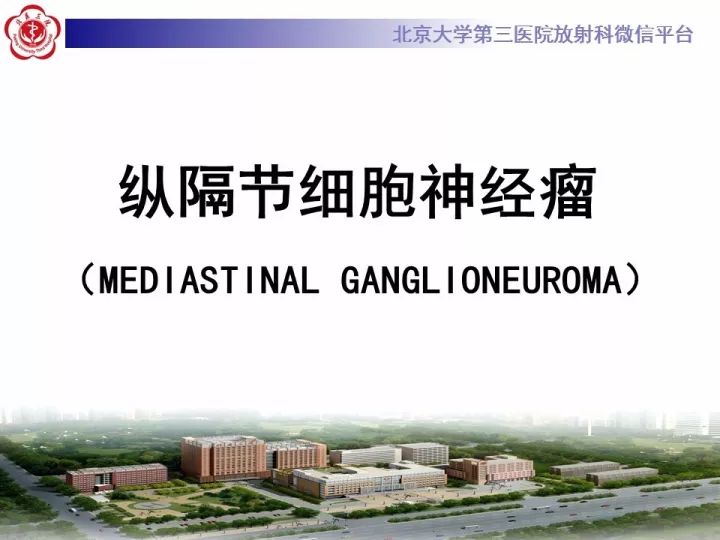 【病例】纵隔神经节细胞神经瘤2例影像诊断