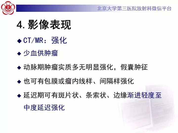 【病例】纵隔神经节细胞神经瘤2例影像诊断