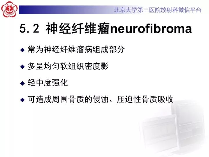 【病例】纵隔神经节细胞神经瘤2例影像诊断