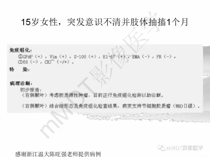 【PPT】颅内节细胞胶质瘤的MR诊断