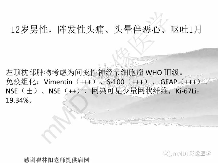 【PPT】颅内节细胞胶质瘤的MR诊断
