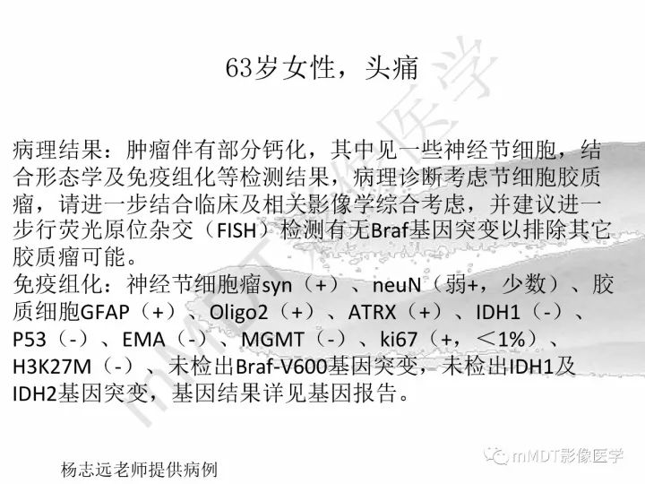 【PPT】颅内节细胞胶质瘤的MR诊断