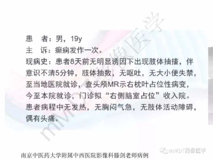 【PPT】颅内节细胞胶质瘤的MR诊断
