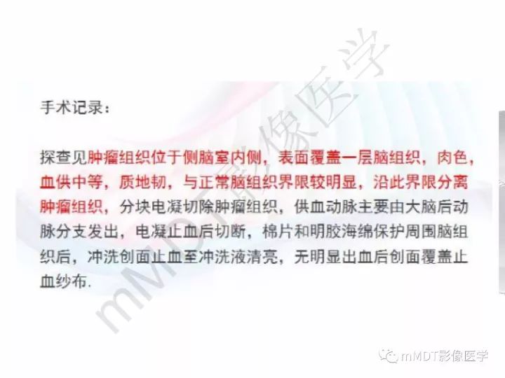 【PPT】颅内节细胞胶质瘤的MR诊断