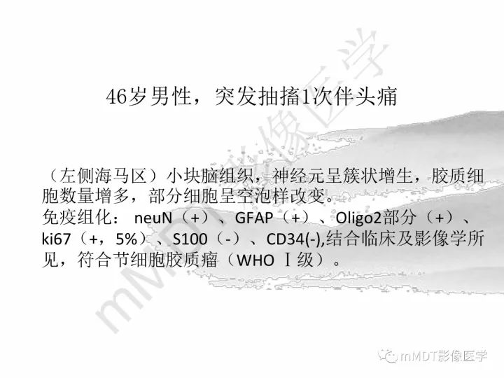 【PPT】颅内节细胞胶质瘤的MR诊断