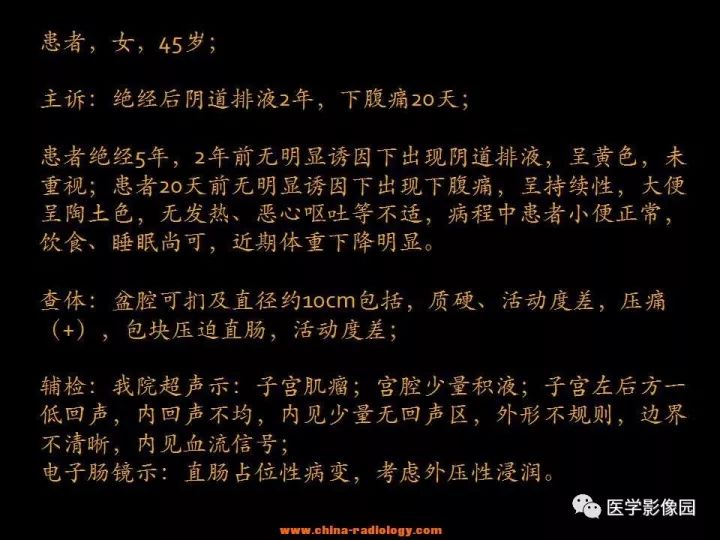 【病例】盆腔脓肿1例MR