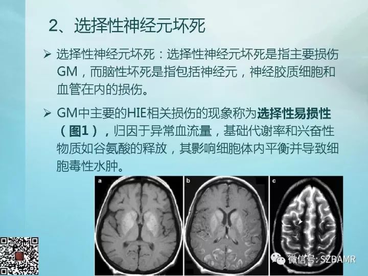 【PPT】非新生儿缺氧缺血性脑病的病理生理学改变及CT和MRI表现