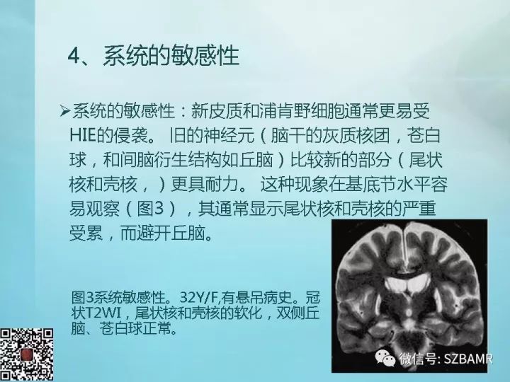【PPT】非新生儿缺氧缺血性脑病的病理生理学改变及CT和MRI表现