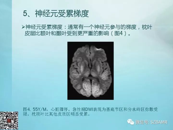 【PPT】非新生儿缺氧缺血性脑病的病理生理学改变及CT和MRI表现