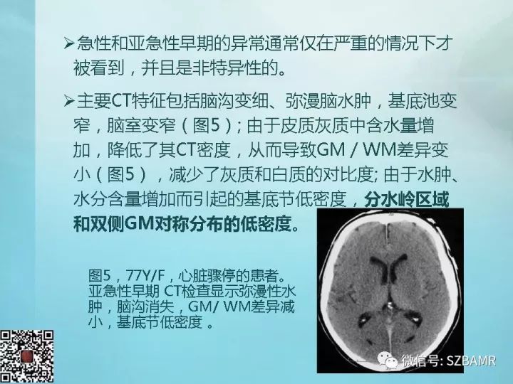 【PPT】非新生儿缺氧缺血性脑病的病理生理学改变及CT和MRI表现