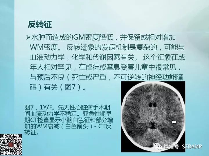 【PPT】非新生儿缺氧缺血性脑病的病理生理学改变及CT和MRI表现