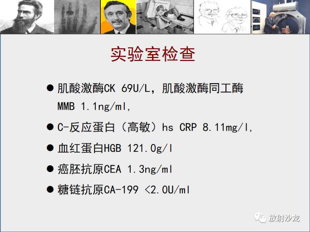 【病例】心房血管肉瘤1例CT及MR影像表现