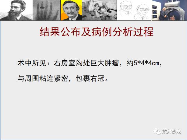 【病例】心房血管肉瘤1例CT及MR影像表现