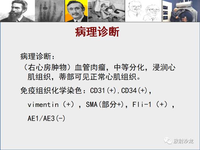 【病例】心房血管肉瘤1例CT及MR影像表现