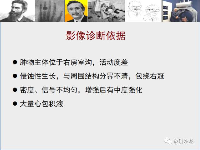 【病例】心房血管肉瘤1例CT及MR影像表现