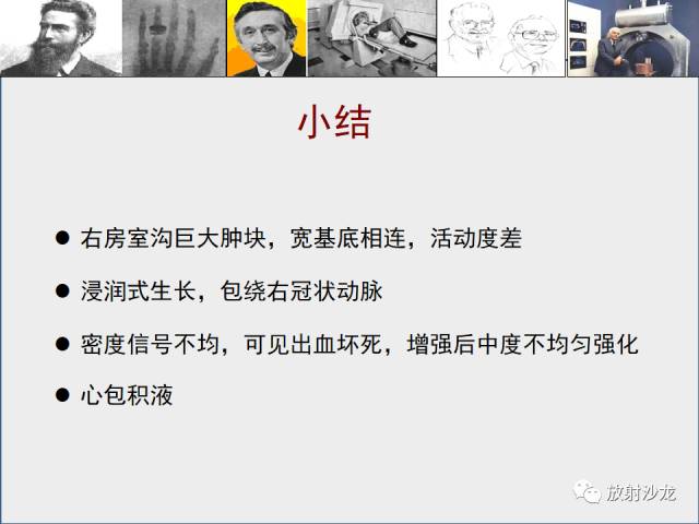 【病例】心房血管肉瘤1例CT及MR影像表现