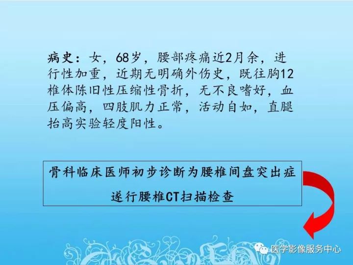 【PPT】一例漏诊腰部CT病例(转移瘤)的启示