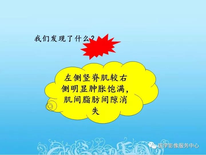 【PPT】一例漏诊腰部CT病例(转移瘤)的启示